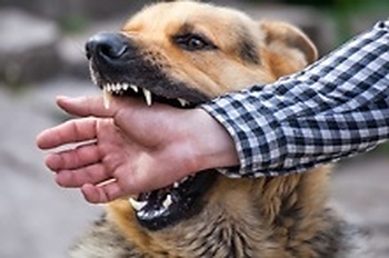 حمله سگ به انسان