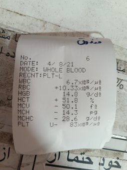 تفسیر ازمایش