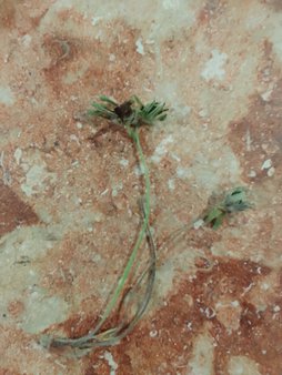 سوختگی
