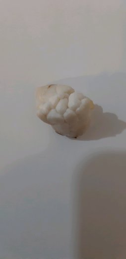 علت شکل بادام