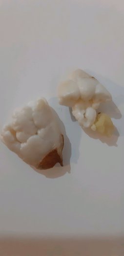 آریس